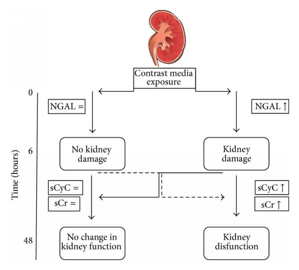 胱抑素C（CysC）與NGAL、肌酐的關(guān)系